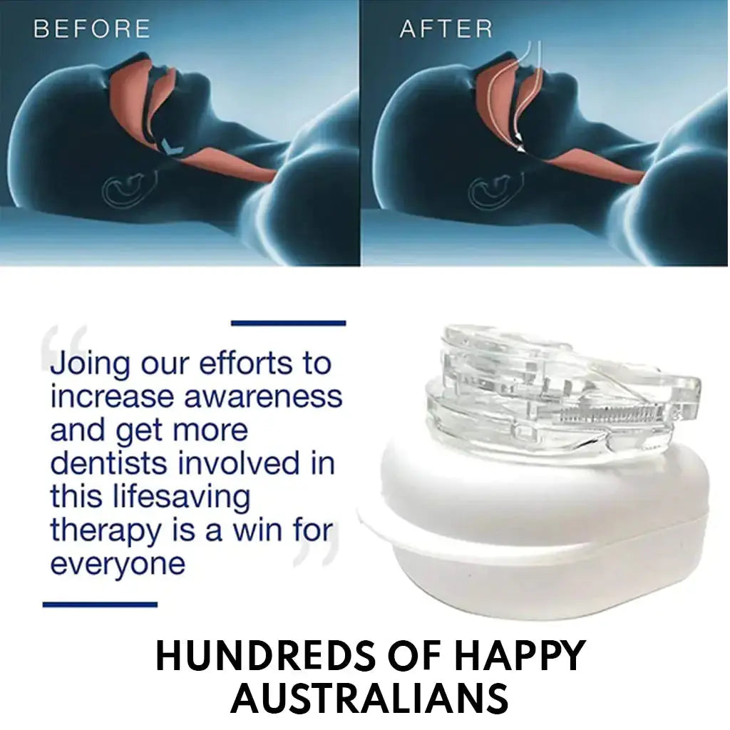 Anti-Snoring Mouthpiece GLR SHOPPING